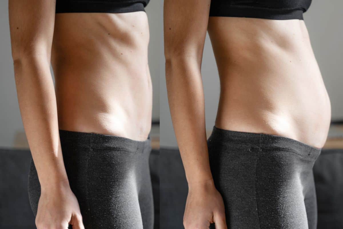 How long does diastasis recti take to improve Godalming?