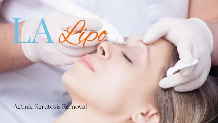 Woman receiving Actinic Keratosis Removal Treatment Godalming