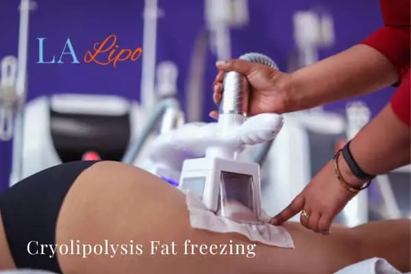 women getting fat freezing Godalming