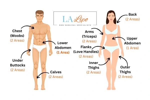LA LIPO Cryolipolysis Areas Godalming