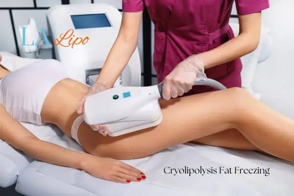 Woman receiving coolsculpting Godalming treatment on her thighs