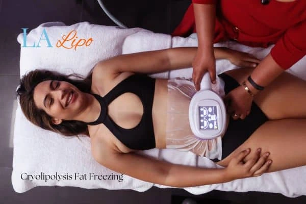 woman getting cryolipolysis Godalming