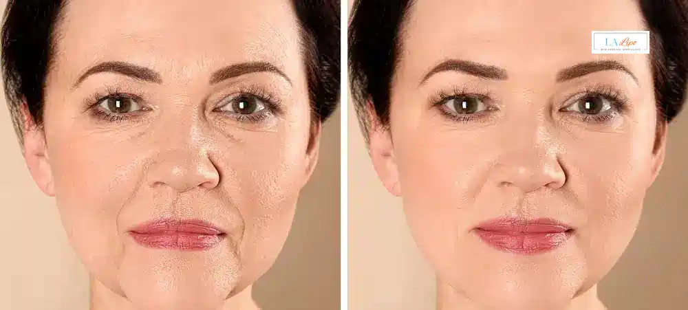 How Long Does It Take to See Results and How Long Do They Last Godalming?