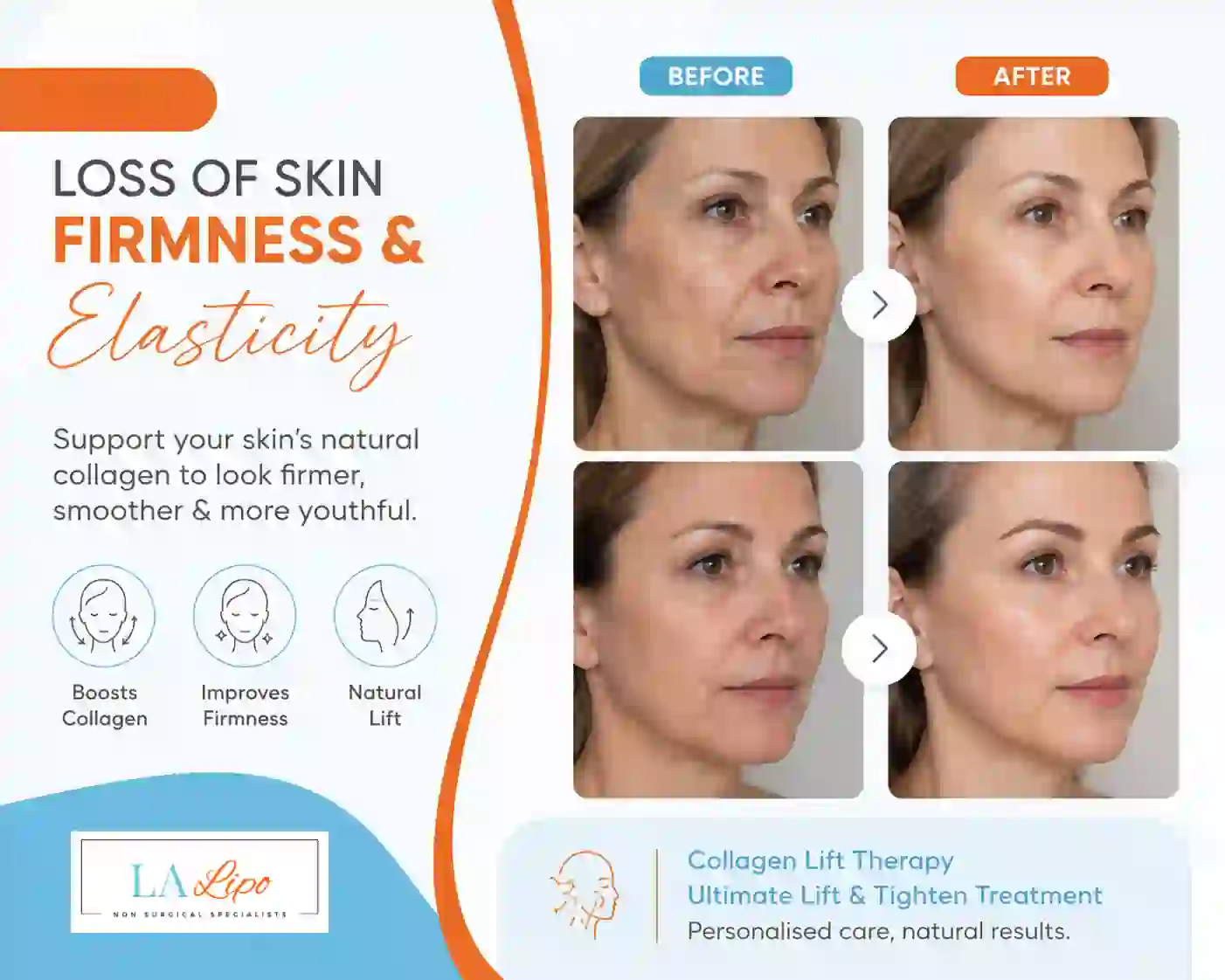 Sign #7: Loss of Skin Firmness and Elasticity Godalming