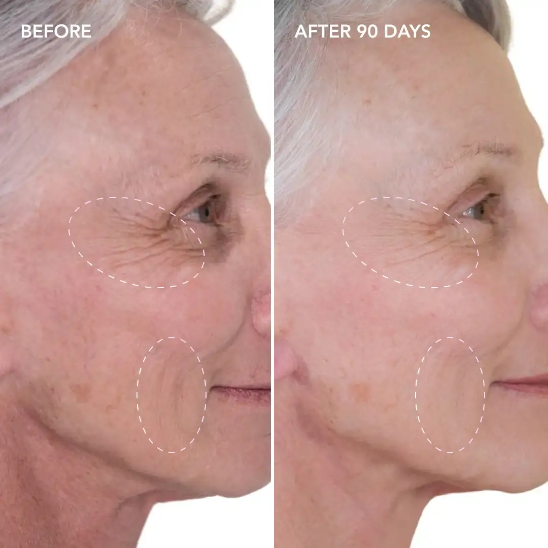 When will you see results Godalming